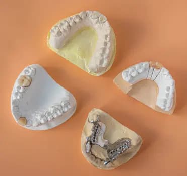 Teeth Image